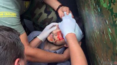 СМИ: Французский журналист во время беспорядков в Киеве получил ранение в голову