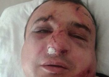 В Киеве избили известного луганского сепаратиста