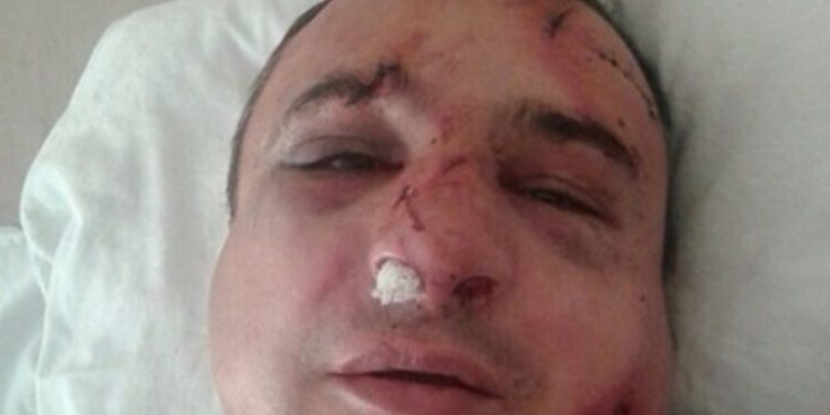 В Киеве избили известного луганского сепаратиста