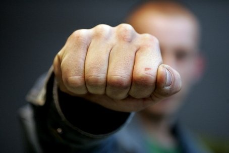 В Луцке возле ночного клуба избили кандидата в депутаты, - пресса