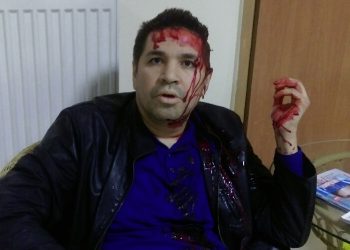 В Харькове случилось покушение на претендента на пост мэра