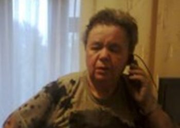 Жительницу Ровно облили кислотой по политическим мотивам