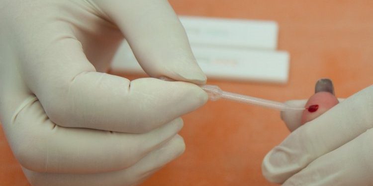 В Киеве зафиксировали вспышку гепатита А, - СМИ