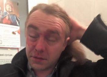 Бывшего нардепа Мирошниченко избил любовник его супруги