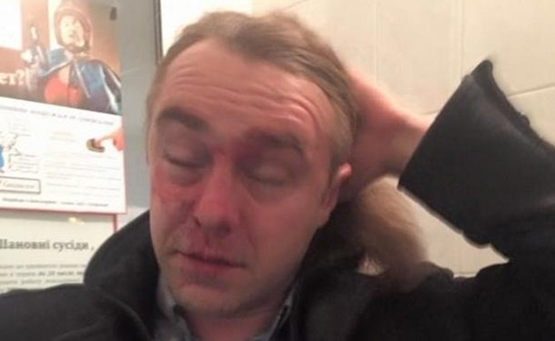 Бывшего нардепа Мирошниченко избил любовник его супруги