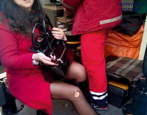 Во Львове на пешеходном переходе машина переехала женщине ногу