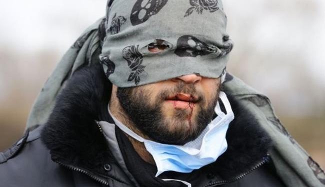 Во Франции беженцы зашили себе рты в знак протеста против сноса лагеря, -пресс