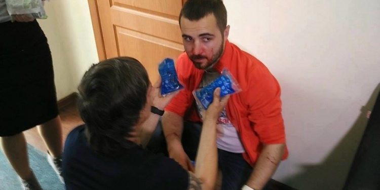 В Одессе открыли огонь по съемочной группе телеканала: есть раненные