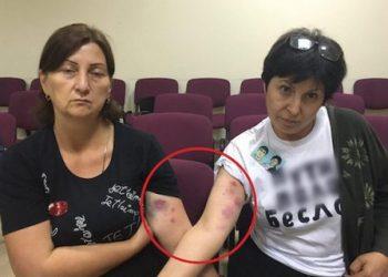 В Беслане второй раз за день напали на сотрудниц СМИ