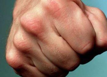 Неизвестные избили двух депутатов Жмеринской горсовета