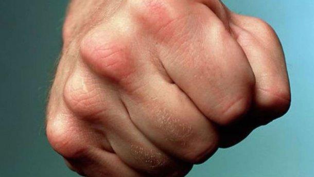 Неизвестные избили двух депутатов Жмеринской горсовета