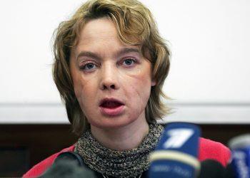 Во Франции умерла первая в мире женщина с пересаженным лицом