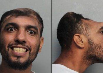 В Майами был задержан «человек с половиной головы» Карлос Родригес