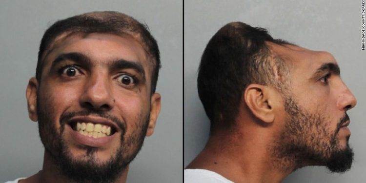 В Майами был задержан «человек с половиной головы» Карлос Родригес